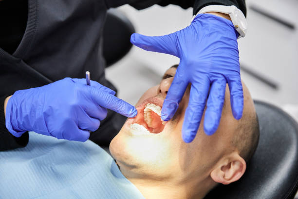 Best Cracked Tooth Emergency Dentist  in South Houston, TX